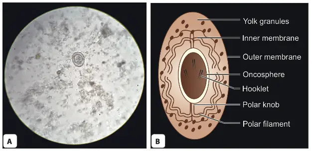 Egg of Hymenolepis nana. A. As seen under microscope; B. Schematic diagram