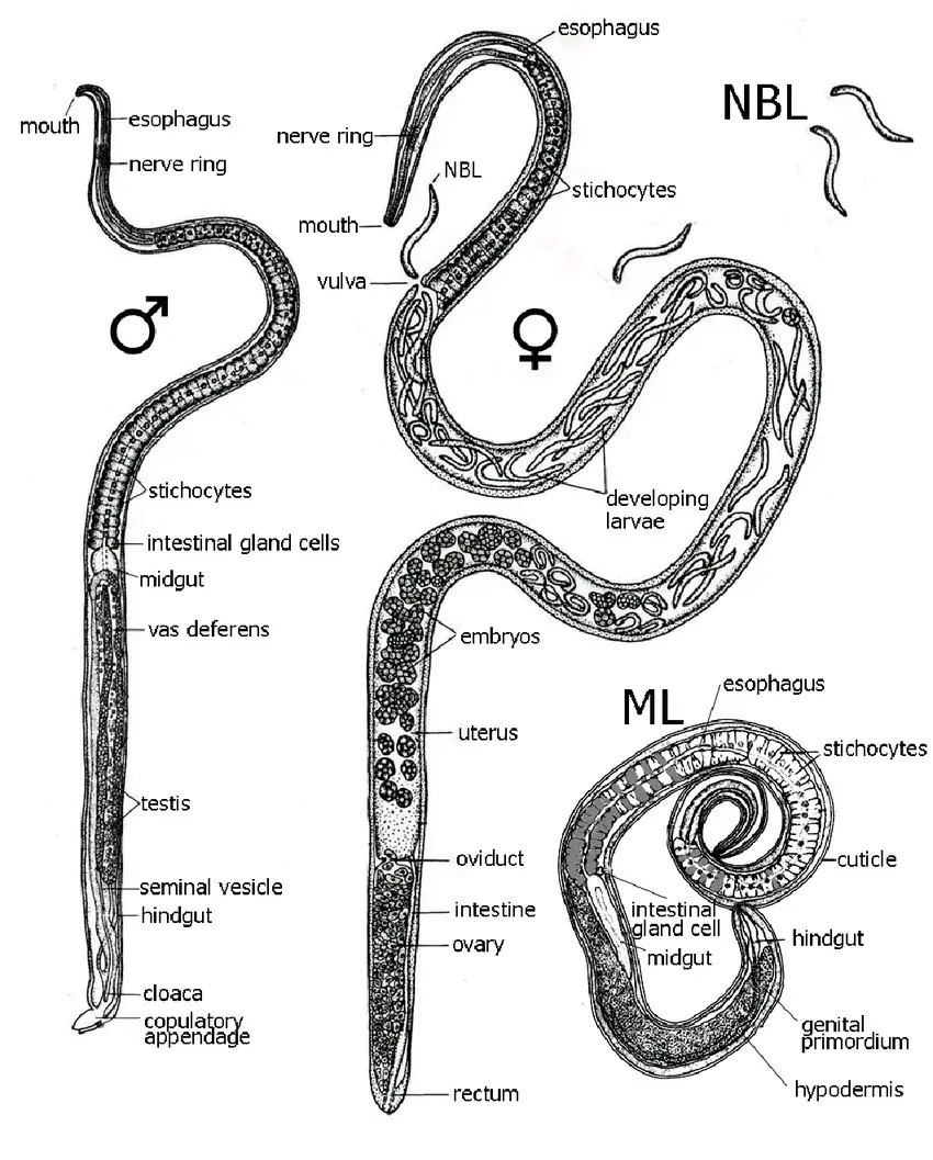 Trichinella spiralis - Morphology, Life Cycle, Pathogenicity, Diagnosis ...