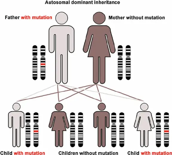 Autosomal dominant inheritance of a mutation (Source: Wikipedia, modifi ed) 