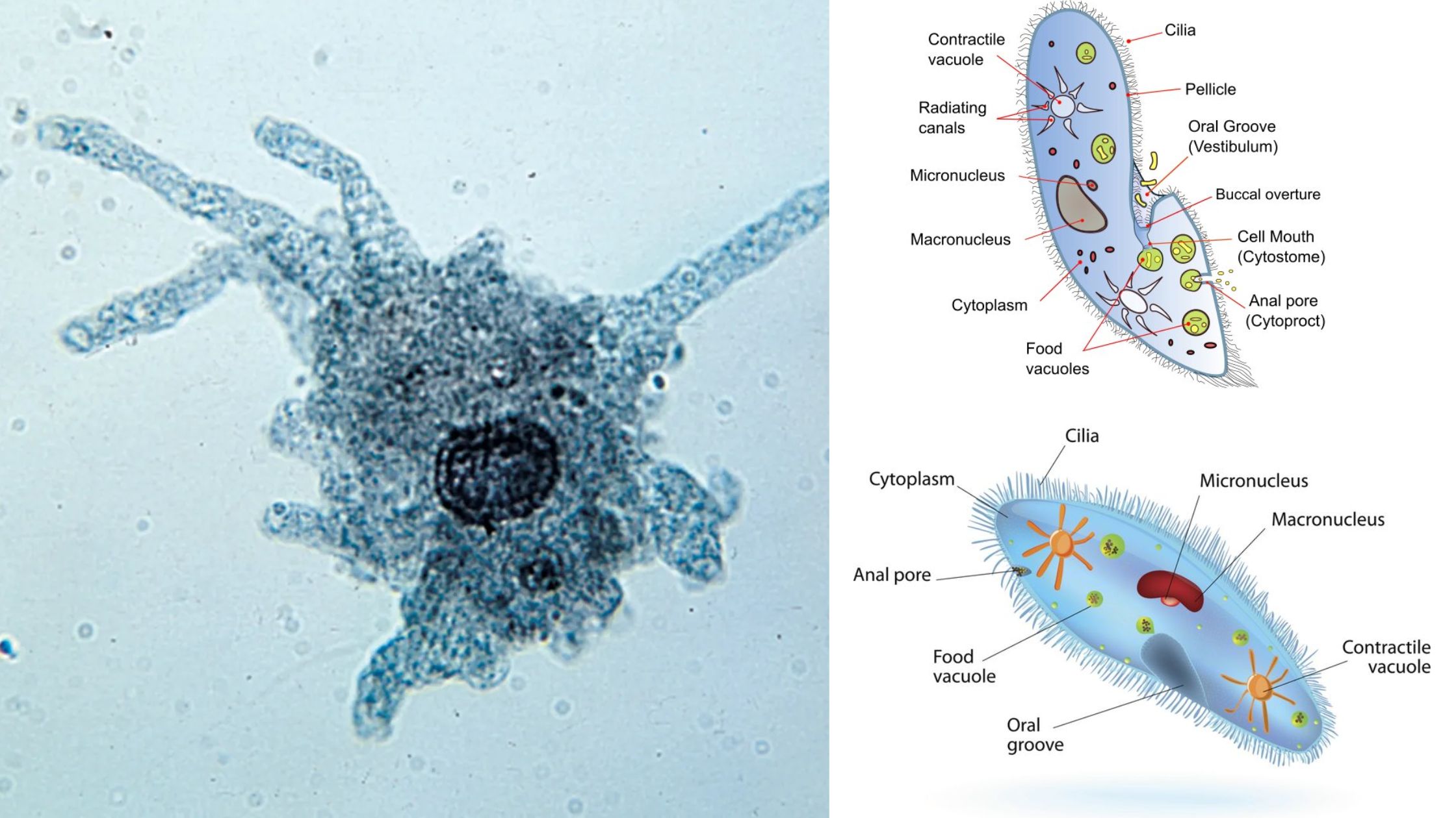 Classification of Protozoa