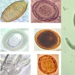 Helminths - Structure, Classification, Life Cycle, Infection, Pathogenesis