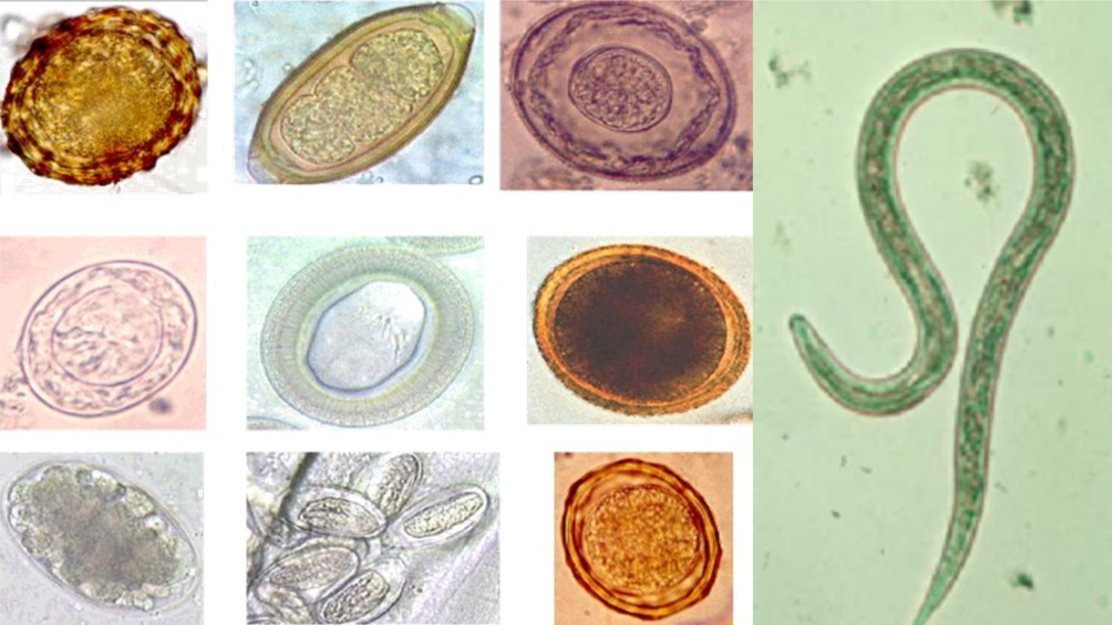 Helminths - Structure, Classification, Life Cycle, Infection, Pathogenesis