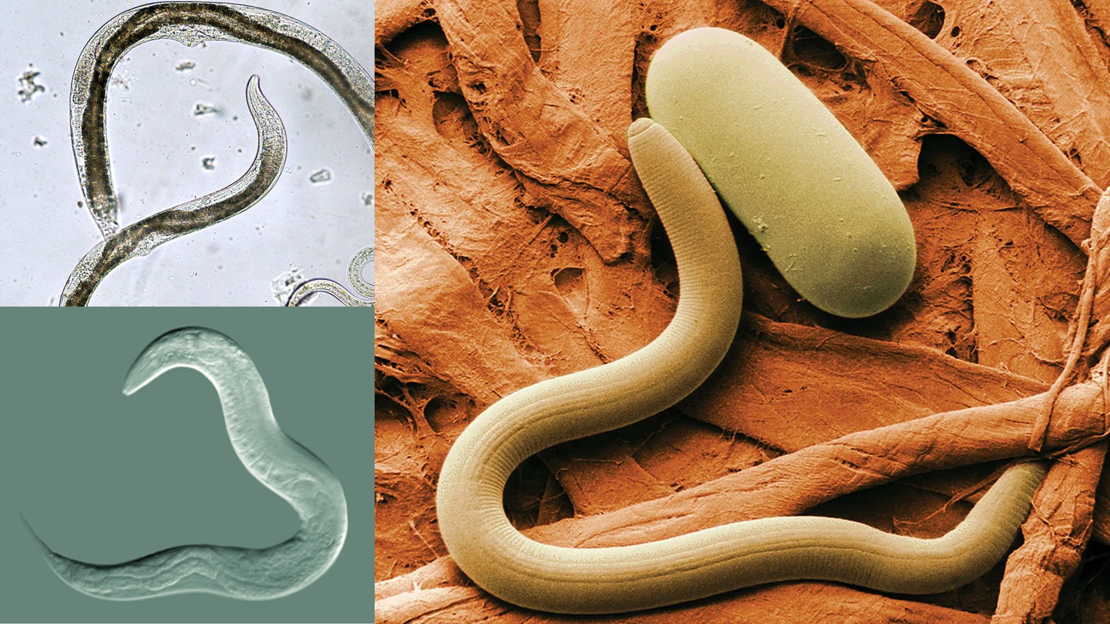 Nematode Examples Phylum Nematoda Features And Classification