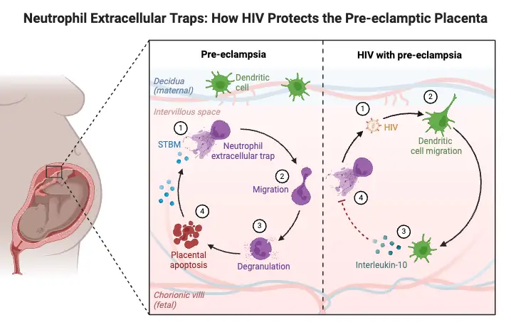 Neutrophil Extracellular Traps_ How HIV Protects the Pre-eclamptic Placenta