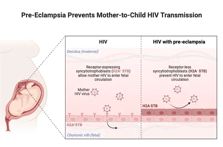 Pre-Eclampsia Prevents Mother-to-Child HIV Transmission