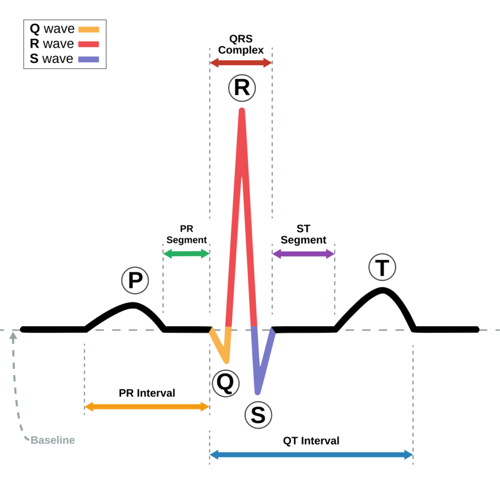 Schematic diagram of sinus rhythm for a human heart as seen on ECG