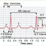 The normal electrocardiogram