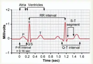 Electrocardiogram (ECG) – Purpose, Principle, Parts, Types, Procedure, Application