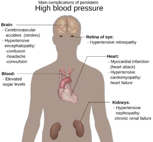 Blood pressure and its regulation