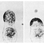 Electrofusion between a celery cell suspension protoplast and a lovage meso- phyll protoplast.