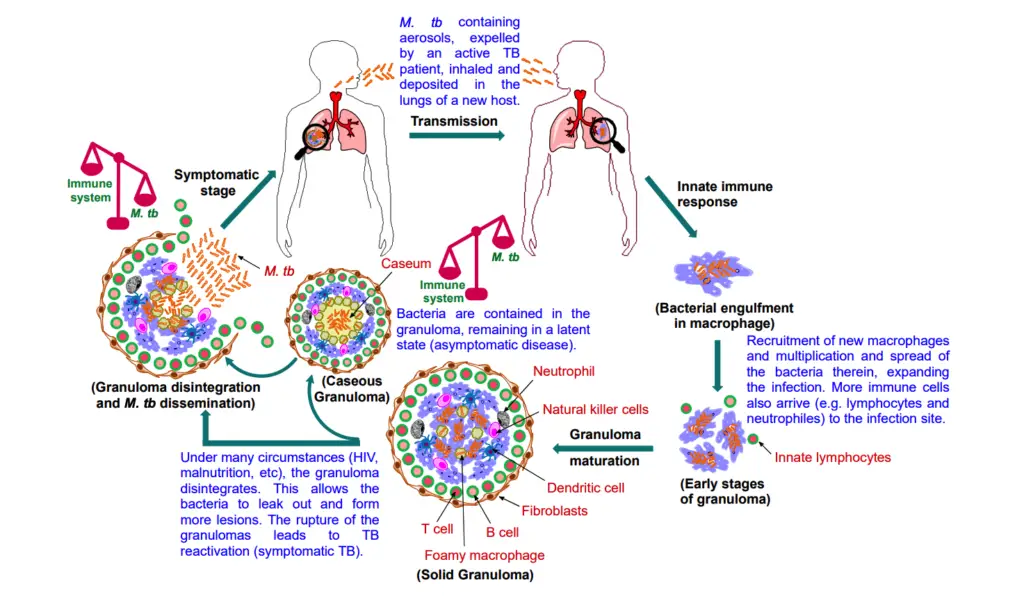 Pathogenesis of Mycobacterium tuberculosis