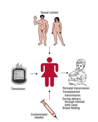 Transmission of HIV Infection