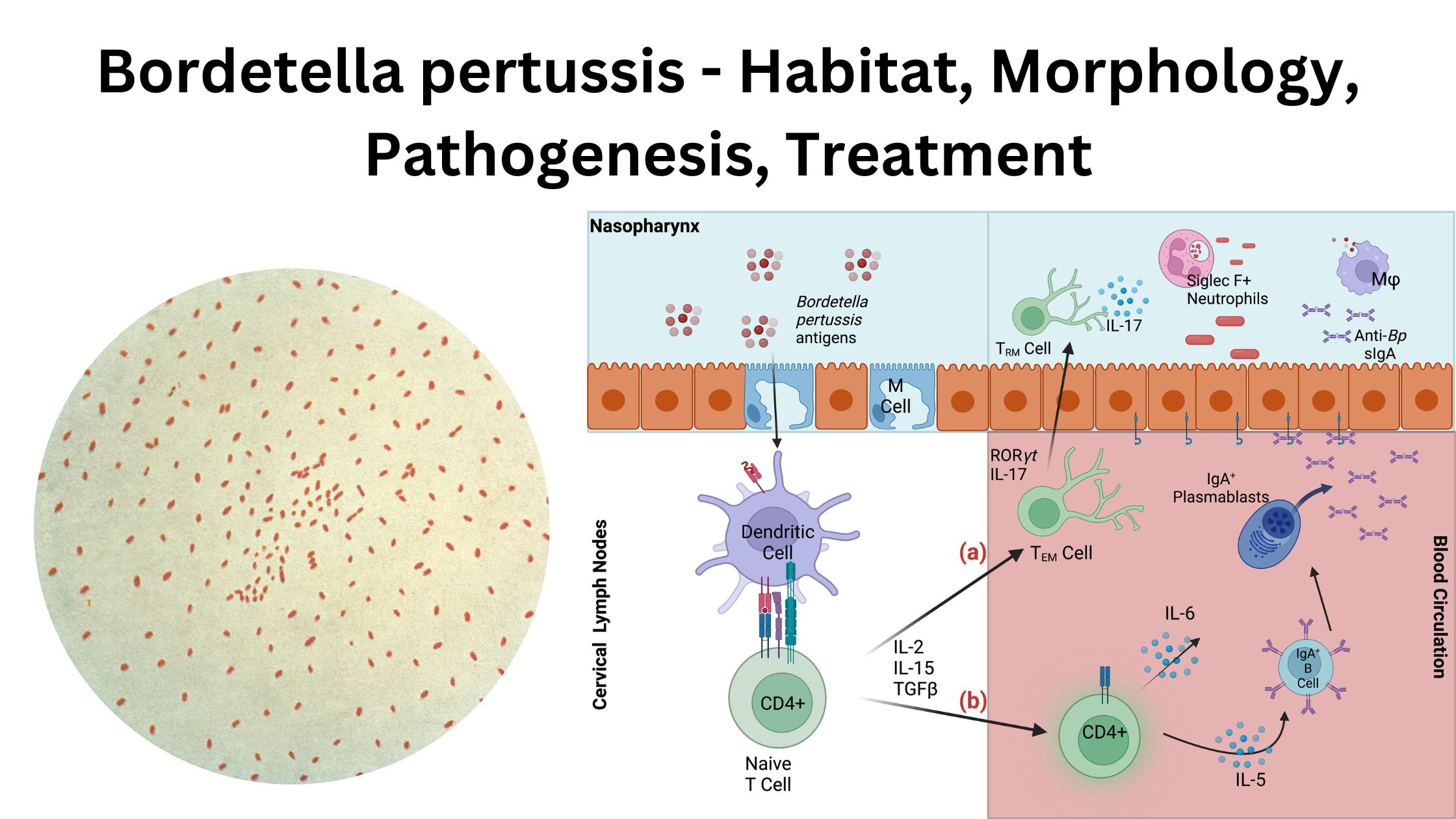 Bordetella pertussis - Habitat, Morphology, Pathogenesis, Treatment