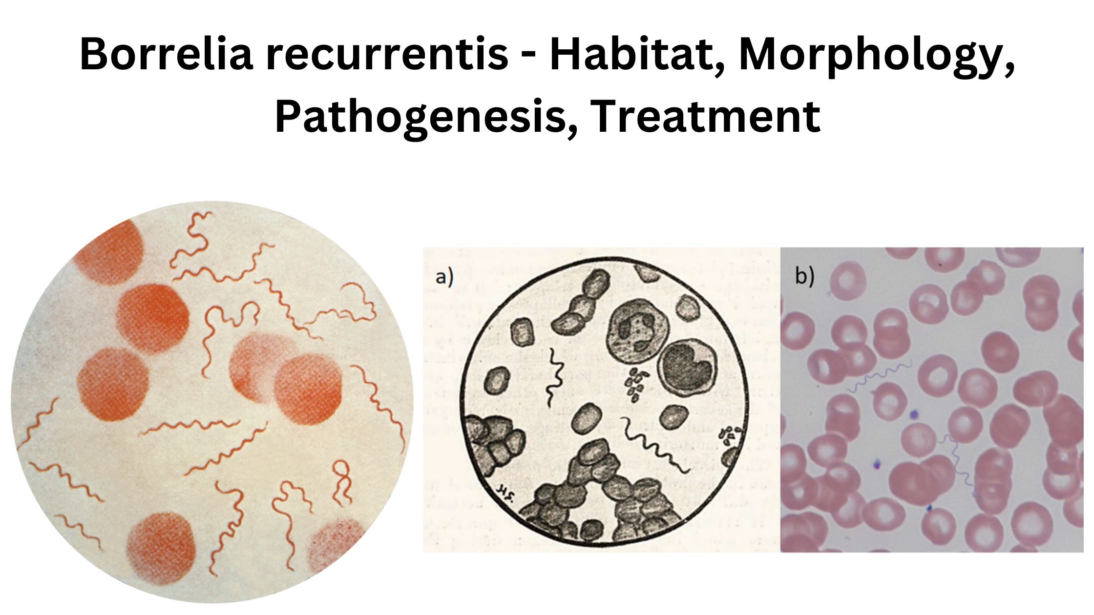 Borrelia recurrentis - Habitat, Morphology, Pathogenesis, Treatment