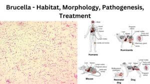 Brucella – Habitat, Morphology, Pathogenesis, Treatment