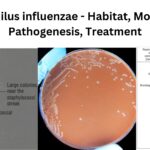 Haemophilus influenzae - Habitat, Morphology, Pathogenesis, Treatment