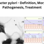 Helicobacter pylori - Definition, Morphology, Pathogenesis, Treatment