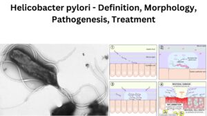 Helicobacter pylori – Definition, Morphology, Pathogenesis, Treatment