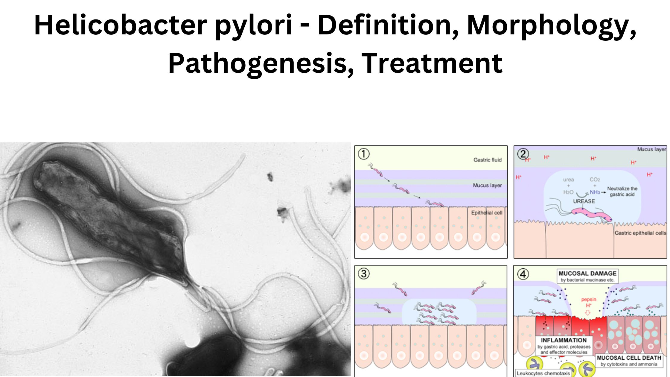 Helicobacter pylori - Definition, Morphology, Pathogenesis, Treatment