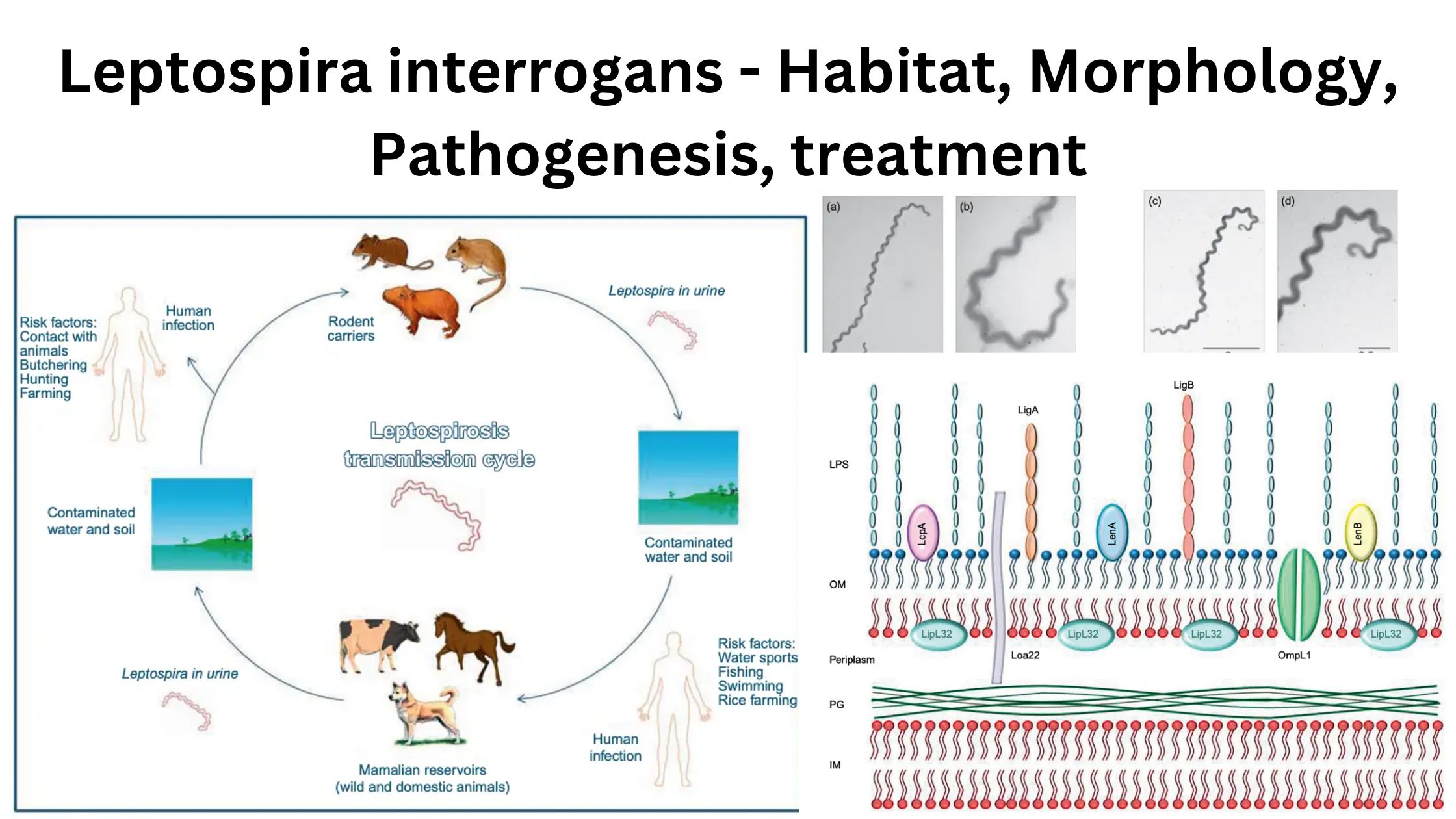 Leptospira interrogans - Habitat, Morphology, Pathogenesis, treatment