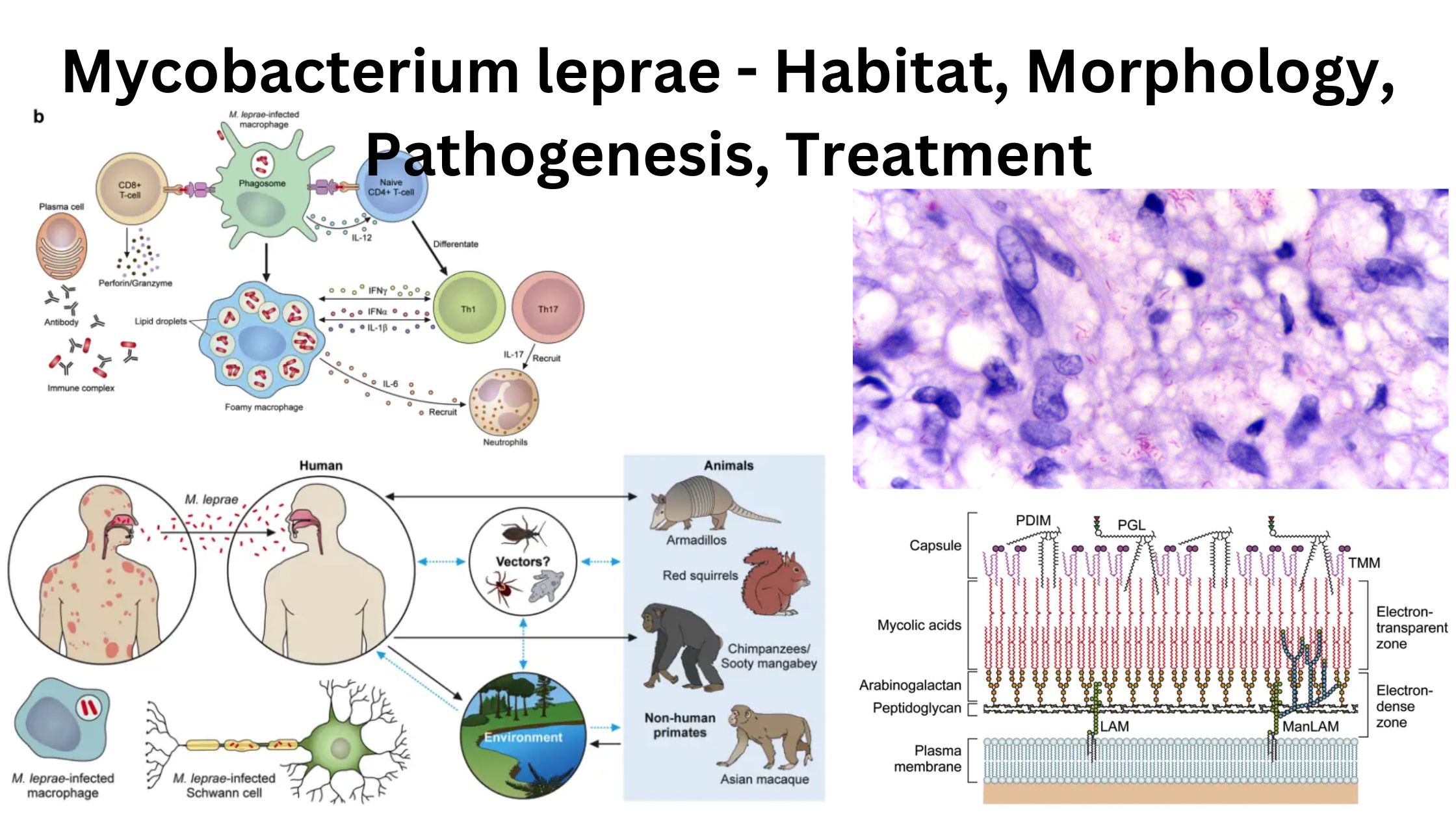 Mycobacterium leprae - Habitat, Morphology, Pathogenesis, Treatment