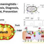 Neisseria meningitidis - Pathogenesis, Diagnosis, Treatment, Prevention