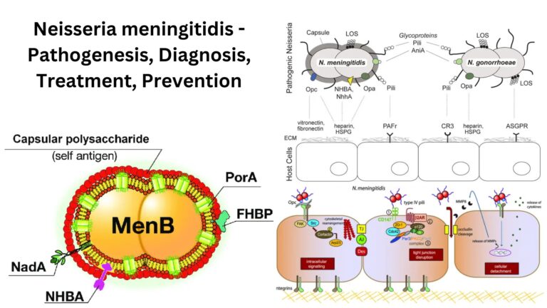 Neisseria meningitidis - Pathogenesis, Diagnosis, Treatment, Prevention