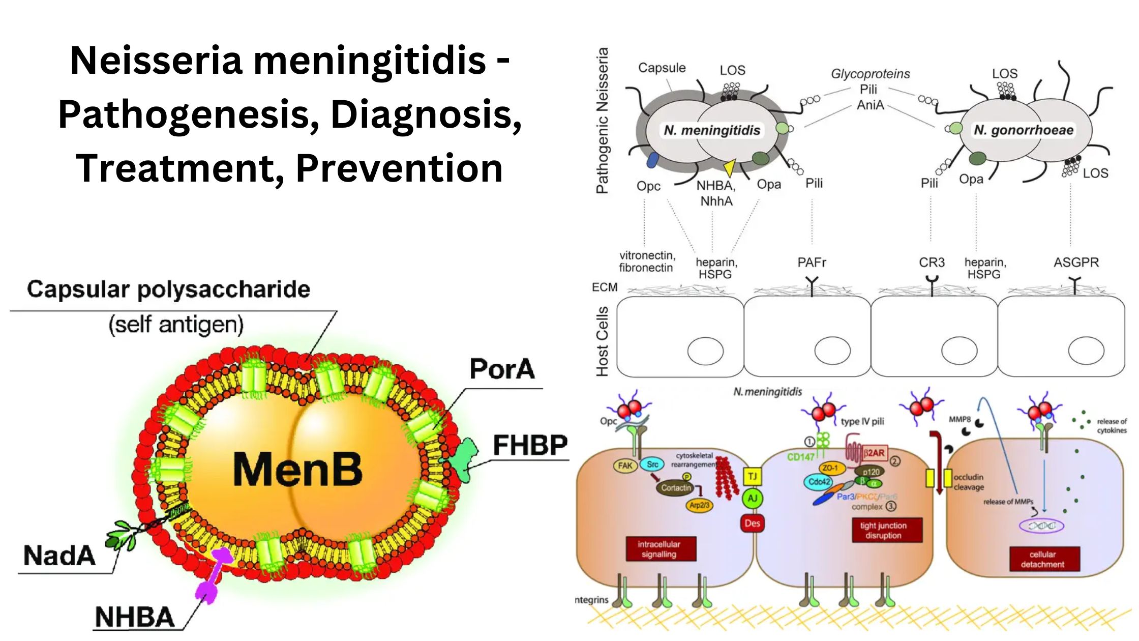 Neisseria meningitidis - Pathogenesis, Diagnosis, Treatment, Prevention