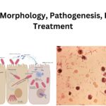 Shigella - Morphology, Pathogenesis, Diagnosis, Treatment