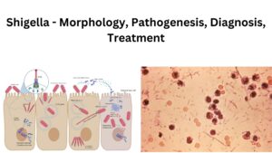 Shigella – Morphology, Pathogenesis, Diagnosis, Treatment