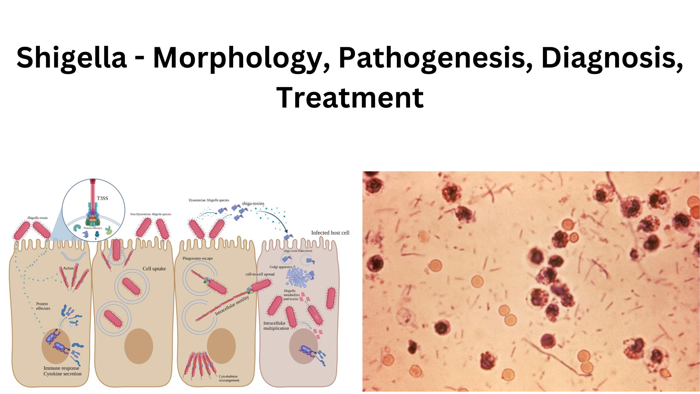 Shigella - Morphology, Pathogenesis, Diagnosis, Treatment