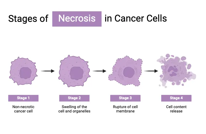 Stage of Necrosis in Cancer Cells