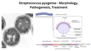 Streptococcus pyogenes – Morphology, Pathogenesis, Treatment