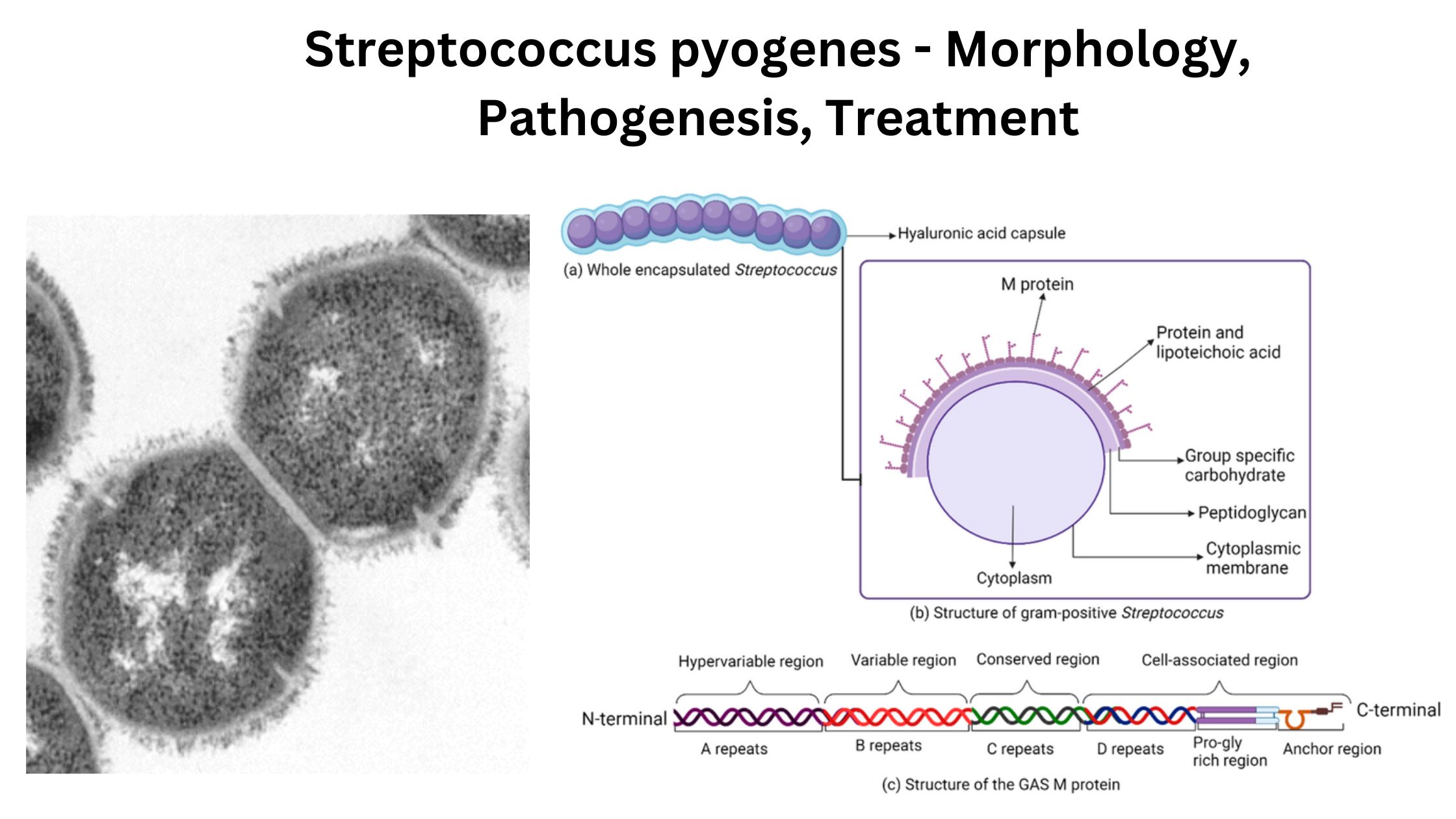 Streptococcus pyogenes - Morphology, Pathogenesis, Treatment