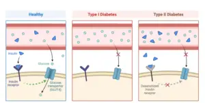 Non-communicable diseases – Types, Control, Examples
