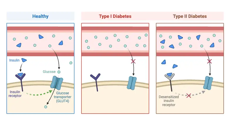 Type I vs. Type II Diabetes