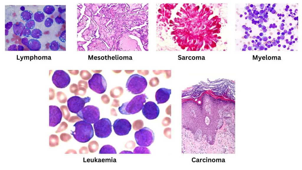 Types of Cancer Cells
