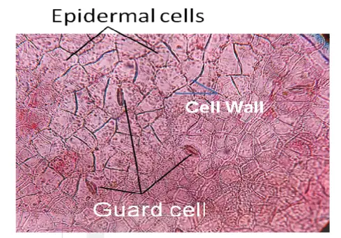 Balsam Leaf Epidermal Cells