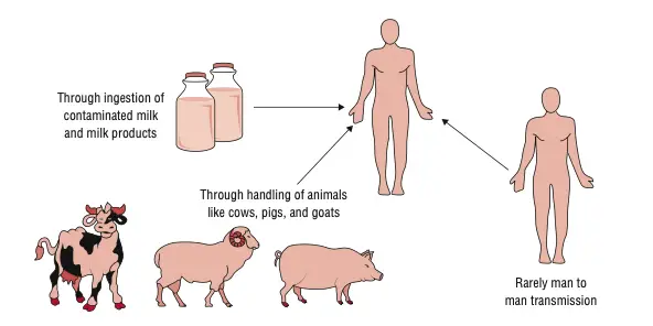 Transmission of brucellosis.