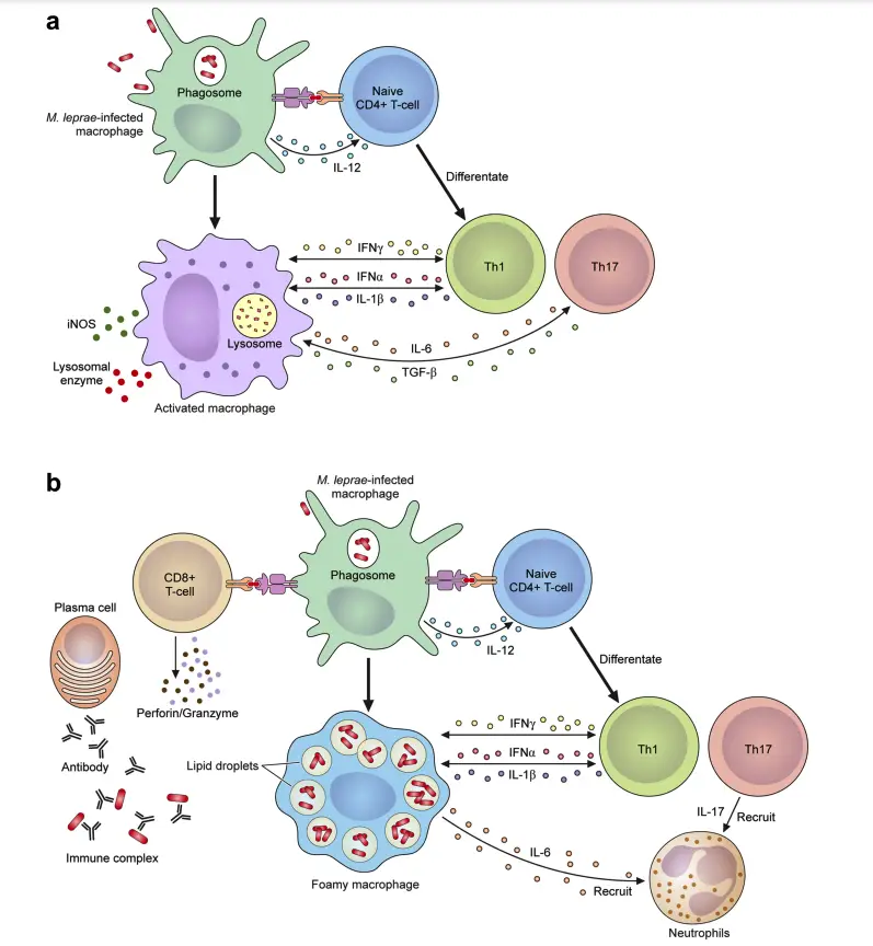 The mechanism of the leprosy reaction.