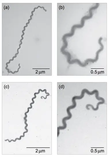 Electron microscopy of leptospires.