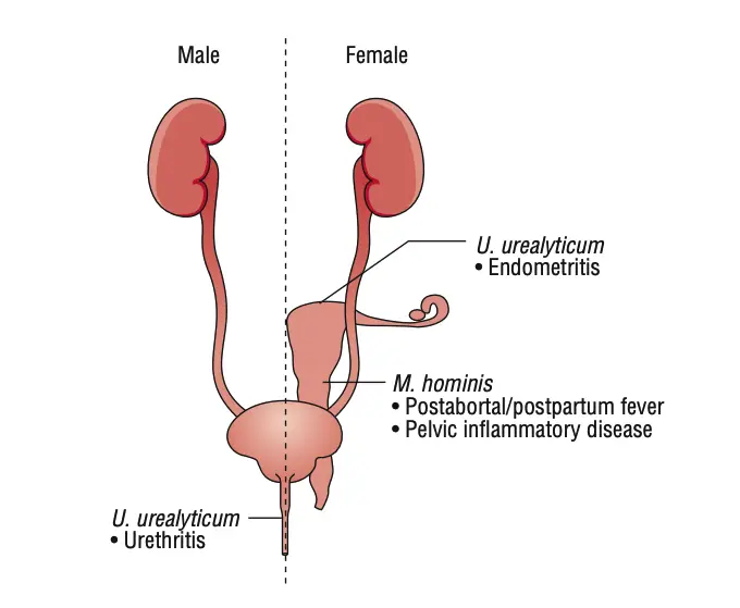 Infections caused by Mycoplasma and Ureaplasma species.