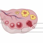Ovary Anatomy