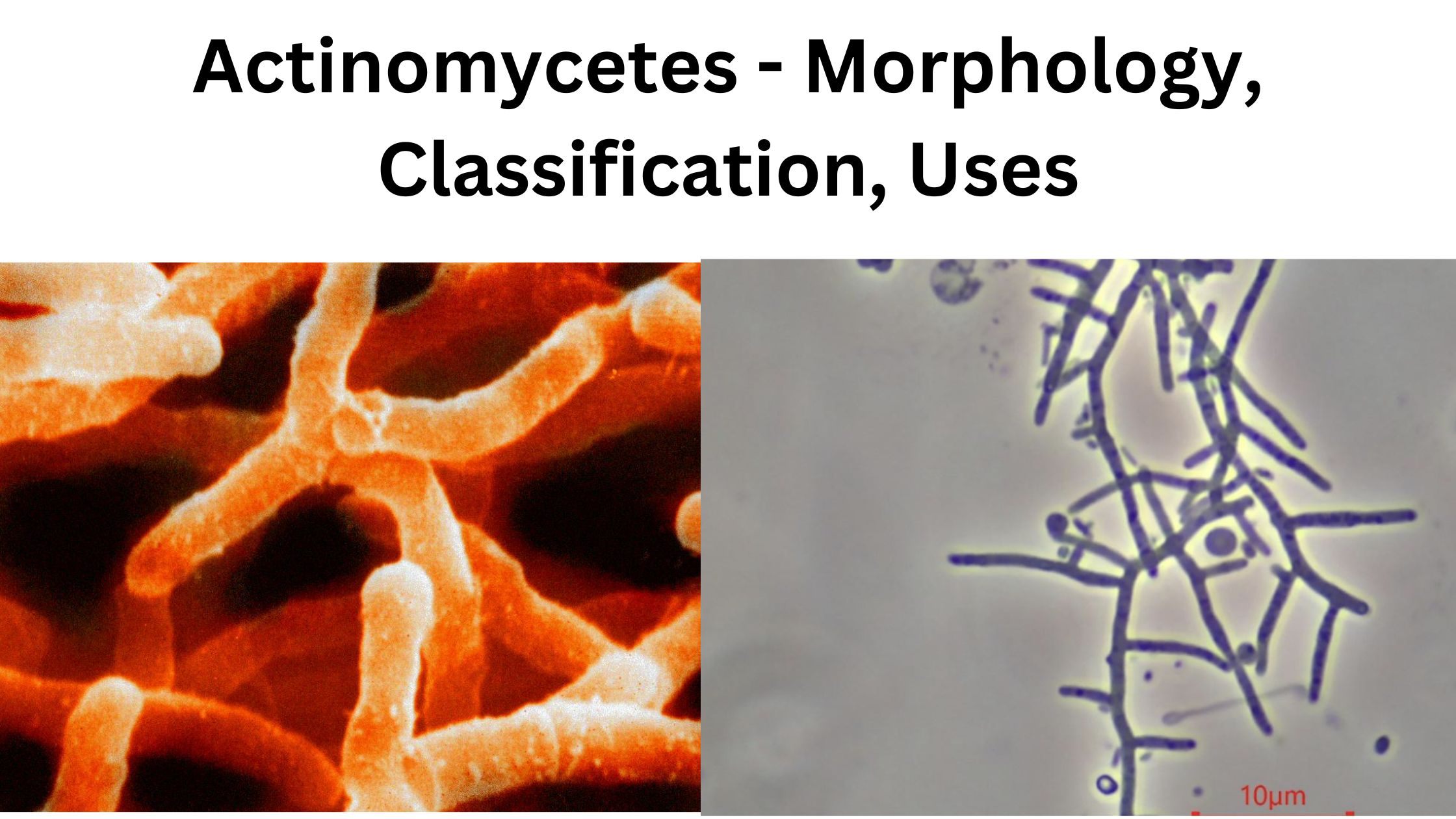 Actinomycetes - Morphology, Classification, Uses