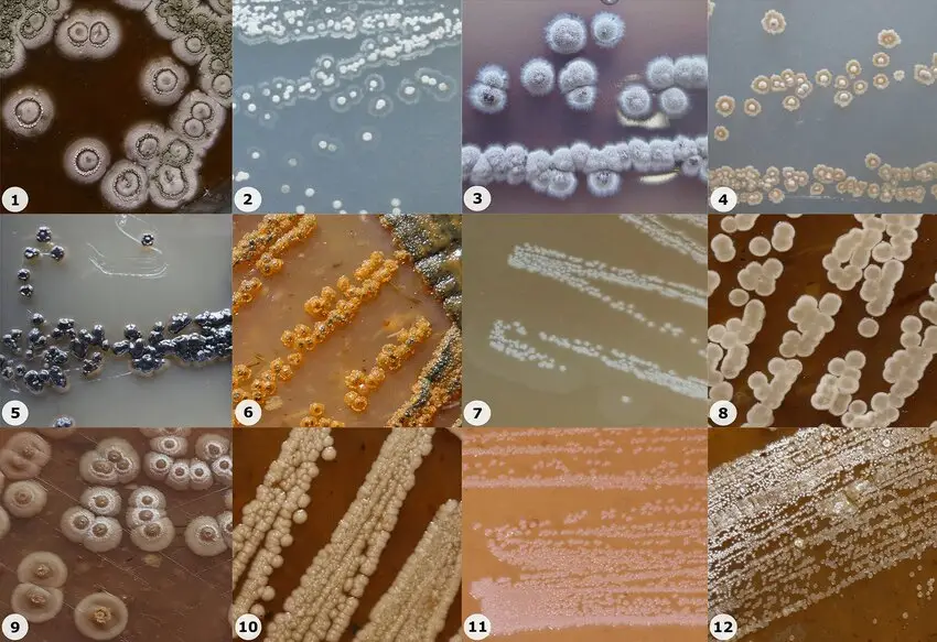 Colony morphology of several actinomycete isolates recovered from the rhizosphere of P. viridiglaucescens: (1) Streptomyces sp. Pv 4-286, (2) Streptomyces sp. Pv 4-26, (3) Streptomyces sp. Pv 4-235, (4) Streptomyces sp. Pv 4-224, (5) Micromonospora sp. Pv 4-96, (6) Micromonospora sp. Pv 4-268, (7) Arthrobacter sp. Pv 4-132, (8) Actinomadura sp. Pv 4-281, (9) Nonomuraea sp. Pv 4-278, (10) Cellulosimicrobium sp. Pv 4-284, (11) Mumia sp. Pv 4-285, (12) Kribbella sp. Pv 4-287
