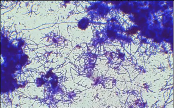 Actinomycetes microorganisms after the application of Gram staining (400-fold magnification).
