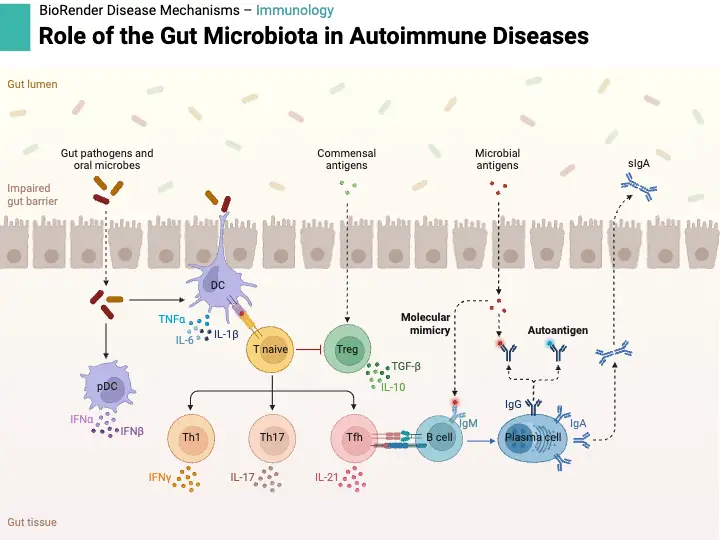 Role of the Gut Microbiota in Autoimmune Diseases