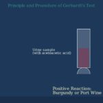 Gerhardt’s Test: Detecting Ketones in Urine