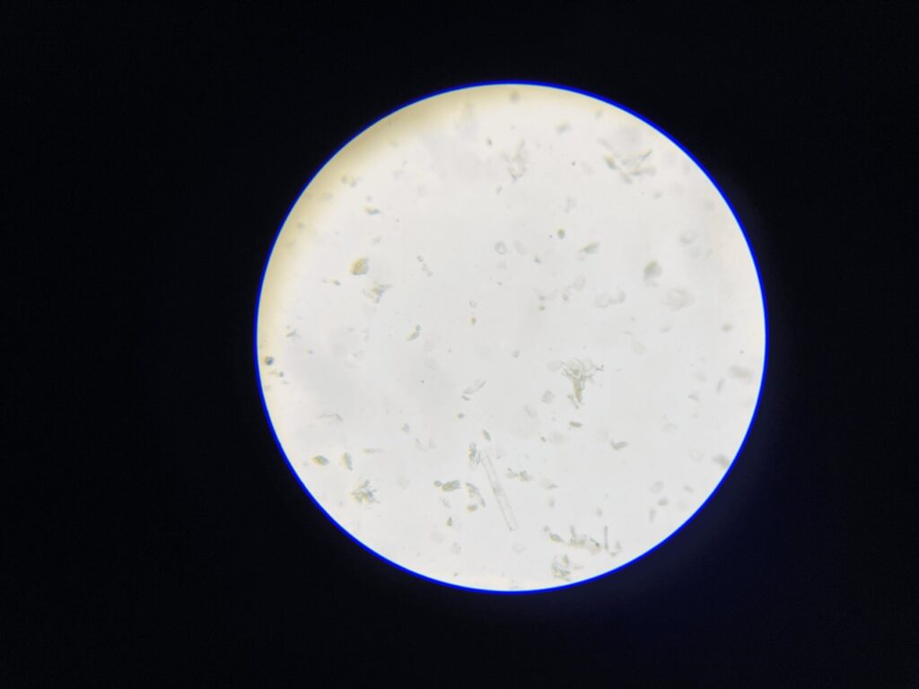 Human Sweat Under Microscope-100x Large