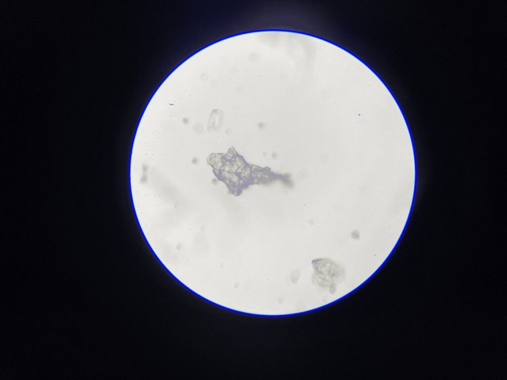 Human Sweat Under Microscope-400x Large